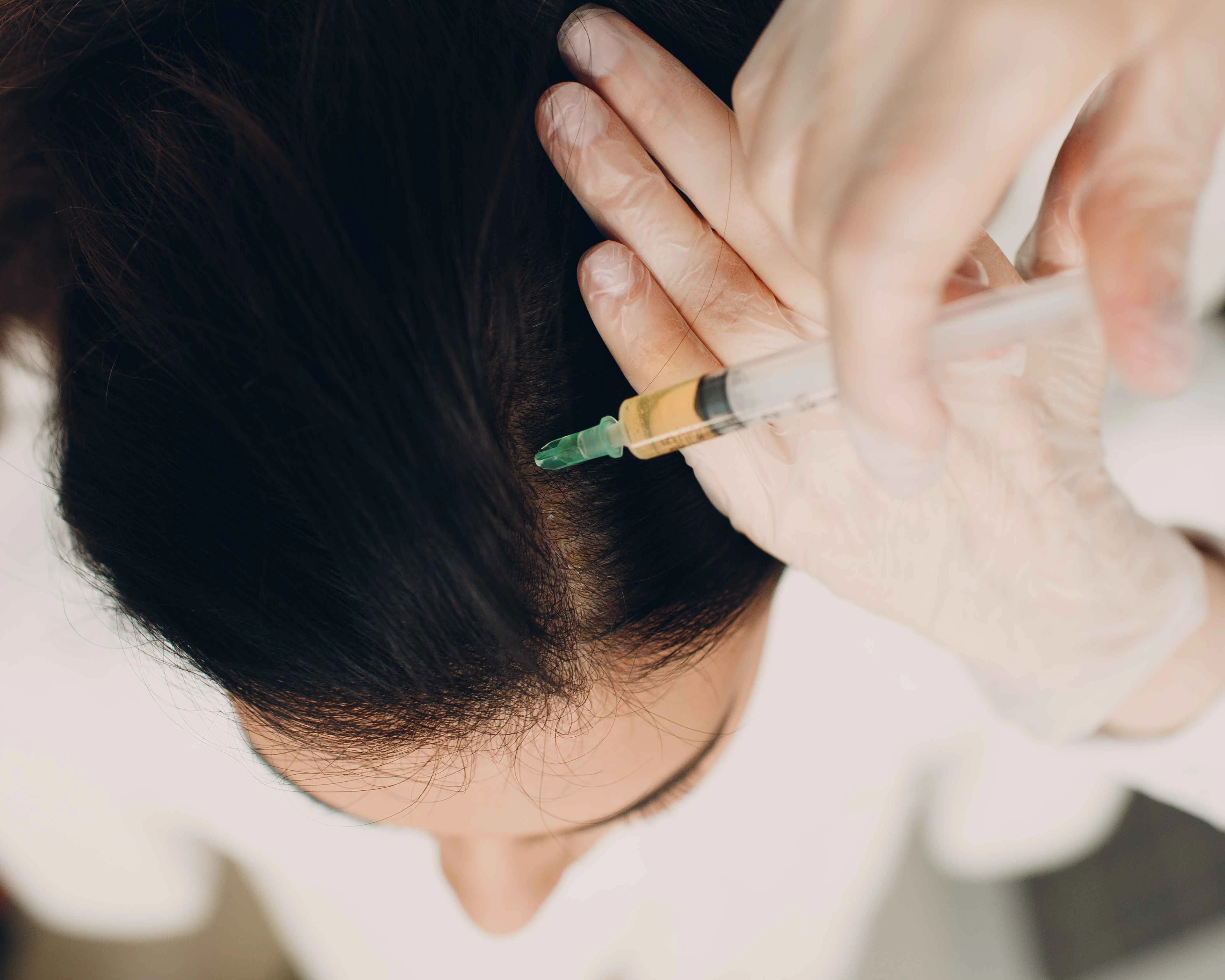 Hair Restoration Center